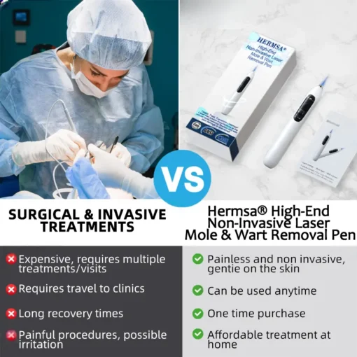 Hermsa® High-End Non-Invasive Laser Mole & Wart Removal Pen