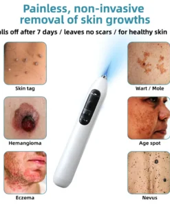 Hermsa® High-End Non-Invasive Laser Mole & Wart Removal Pen