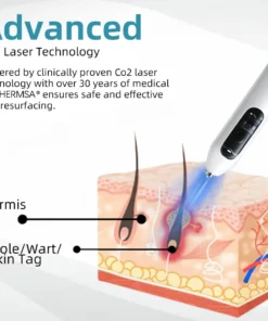 Hermsa® High-End Non-Invasive Laser Mole & Wart Removal Pen