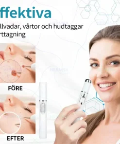 Hermsa® Non-Invasive Laser Pen - Mole and Wart Removal