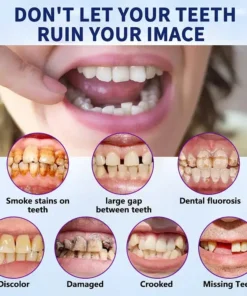 Hermsa® Easy-Fit Silicone Dentures – For Eating, Smiling, and Daily Comfort