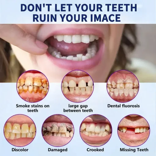 Hermsa® Easy-Fit Silicone Dentures – For Eating, Smiling, and Daily Comfort