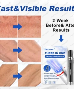 Hermsa® Multi-Functional Laser Pen Three In One Beauty Safety Device