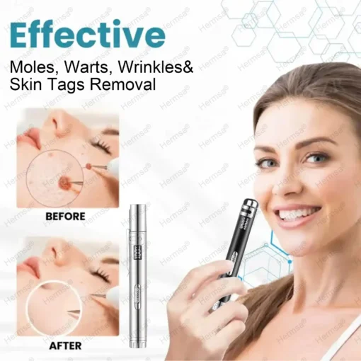 Hermsa® Multi-Functional Laser Pen Three In One Beauty Safety Device