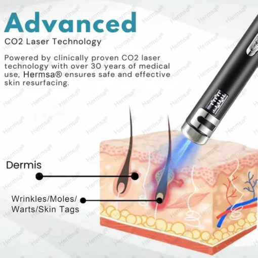 Hermsa® Multi-Functional Laser Pen Three In One Beauty Safety Device