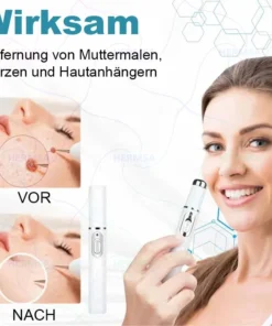 Hermsa® non-invasive laser pointer - mole and wart removal