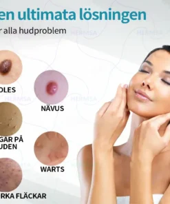 Hermsa® Ei-invasiivinen Laserkynä - Syntymämerkkien ja Syylien Poisto (Viimeinen päivä 80 ALE)